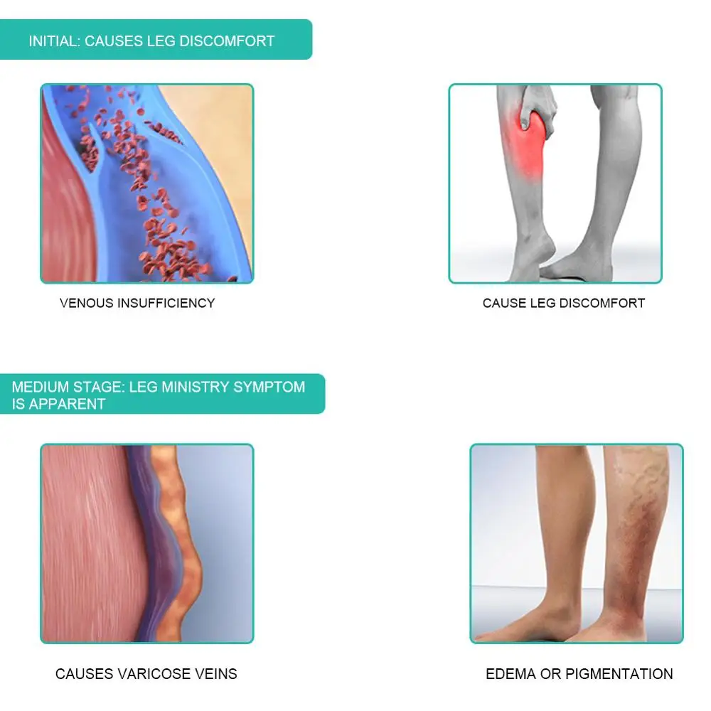1Pair Medical Compression Sock - Compression Sleeve Calf review and price
