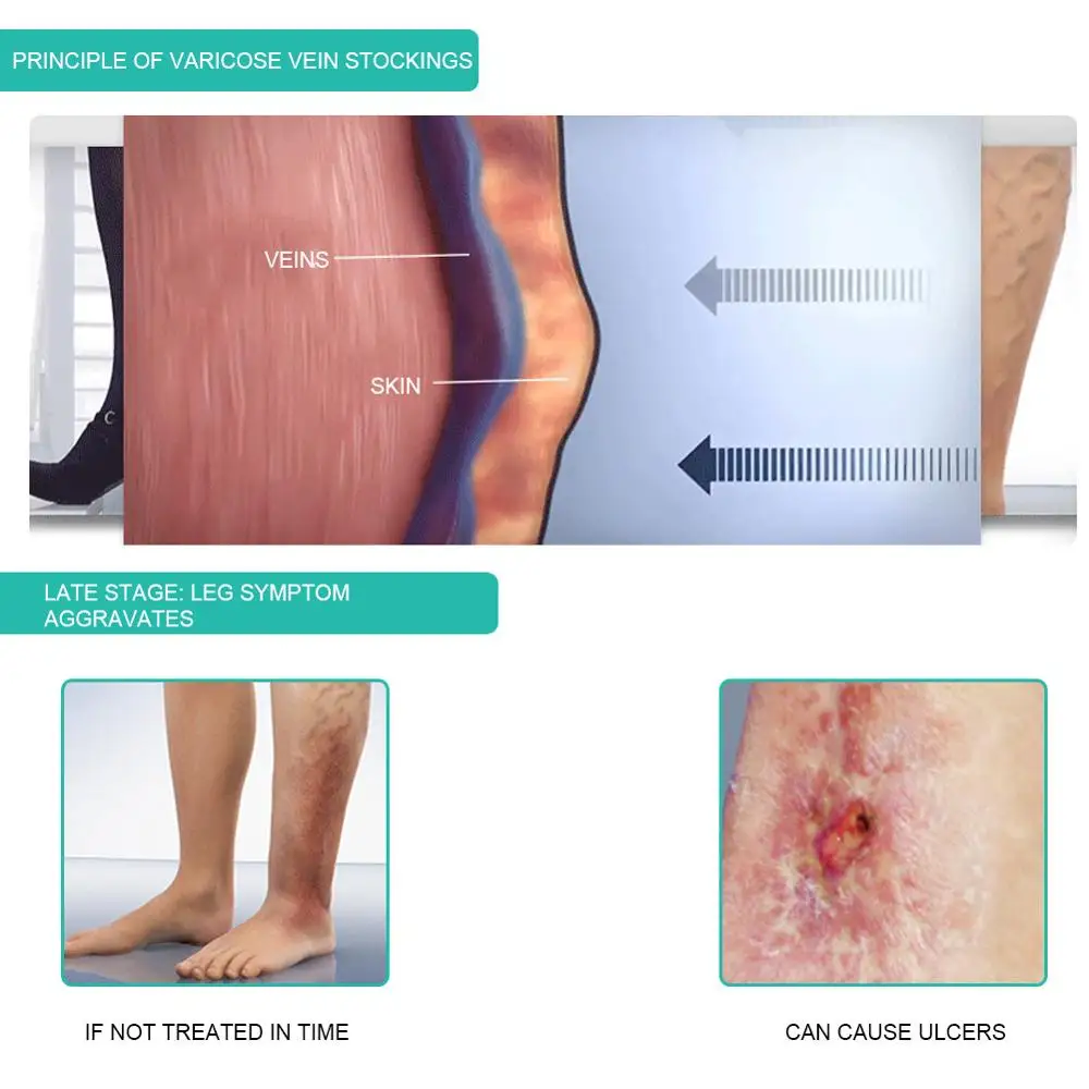 1Pair Medical Compression Sock - Compression Sleeve Calf review and price